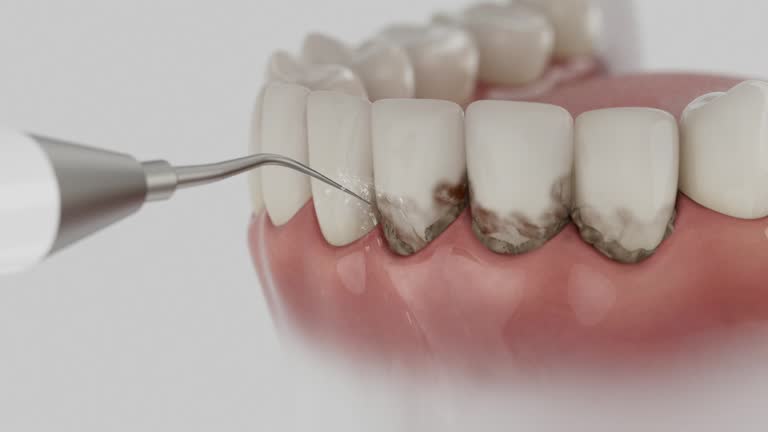 Trusted Dental Crowns And Bridges service in Buckner, MO - Dentist Open Now
